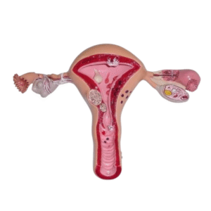 Anatomical model of normal and pathological cervix