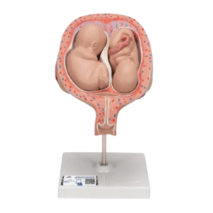 Twin fetus model