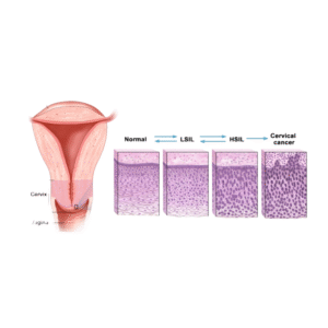 Anatomical model for cervical lesion screening