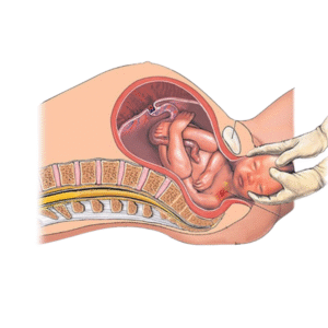 Obstetric pelvis